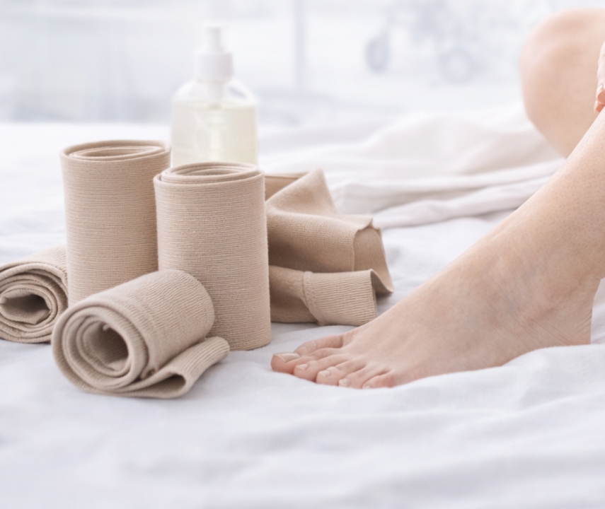 J’ai été diagnostiquée d’un lipœdème